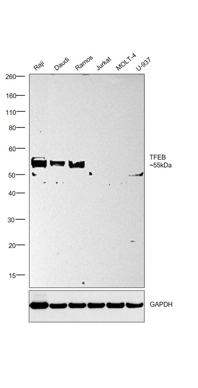 TFEB Antibody in Western Blot (WB)