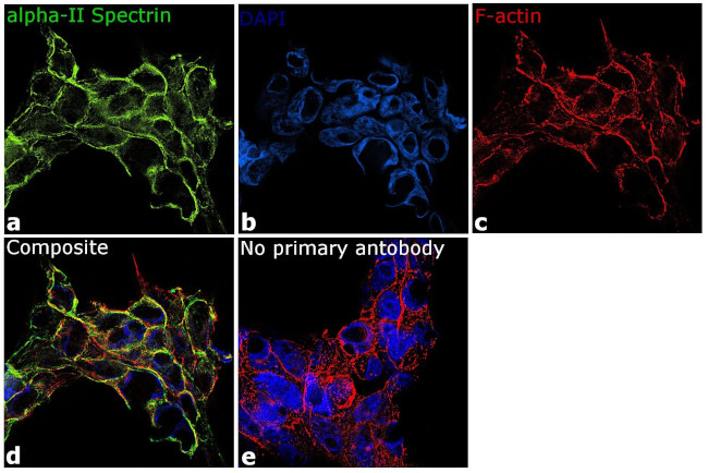 alpha-II Spectrin Antibody in Immunocytochemistry (ICC/IF)