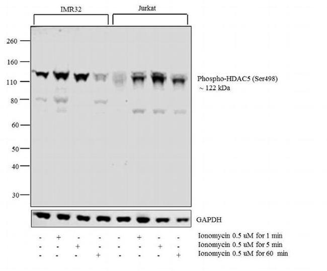 Phospho-HDAC5 (Ser498) Antibody in Western Blot (WB)