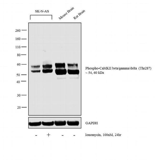 Phospho-CaMKII beta/gamma/delta (Thr287) Antibody in Western Blot (WB)