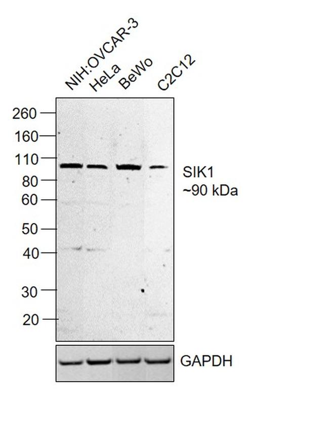 SIK1 Antibody in Western Blot (WB)