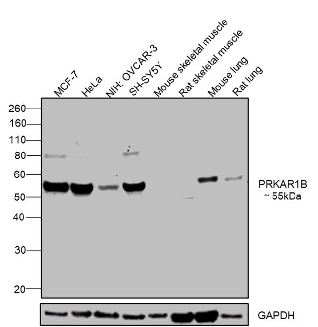 PRKAR1B Antibody in Western Blot (WB)