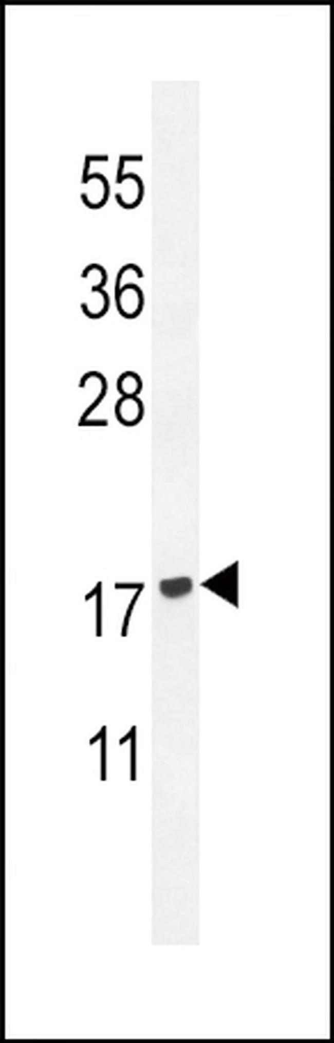 PLA2G2D Antibody in Western Blot (WB)