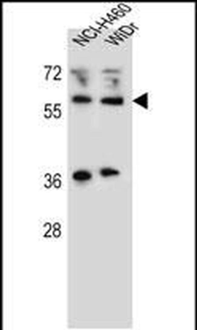 WTIP Antibody in Western Blot (WB)