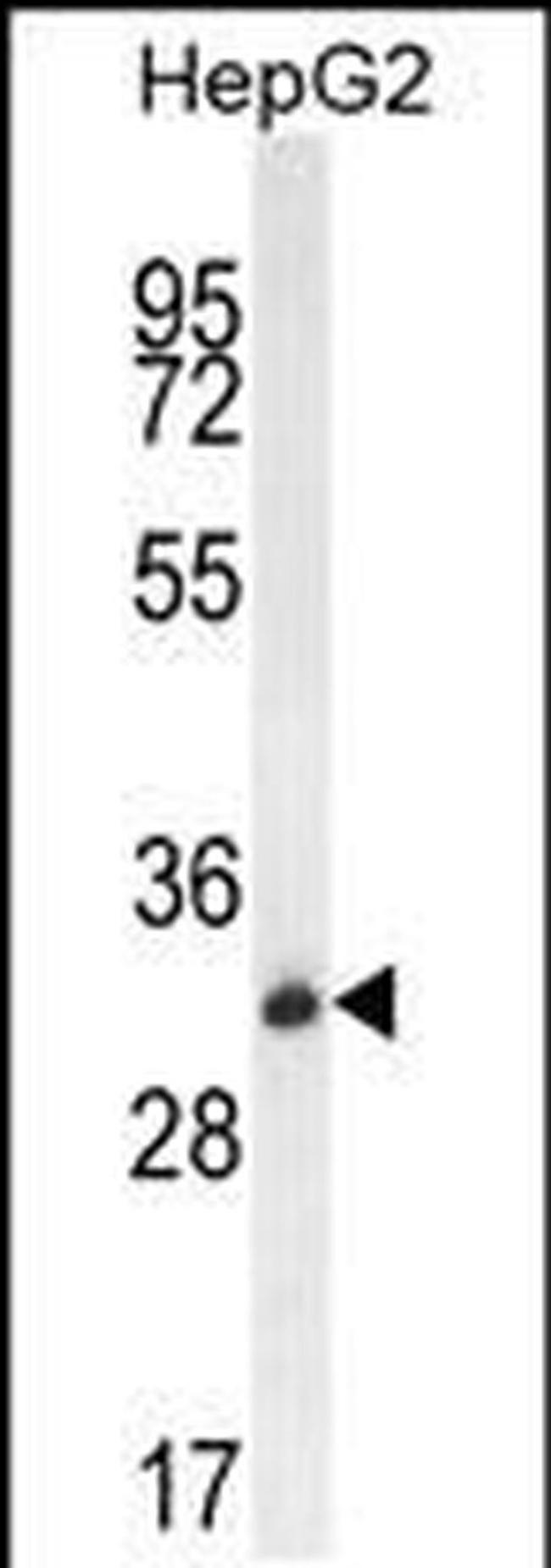 OR4K5 Antibody in Western Blot (WB)