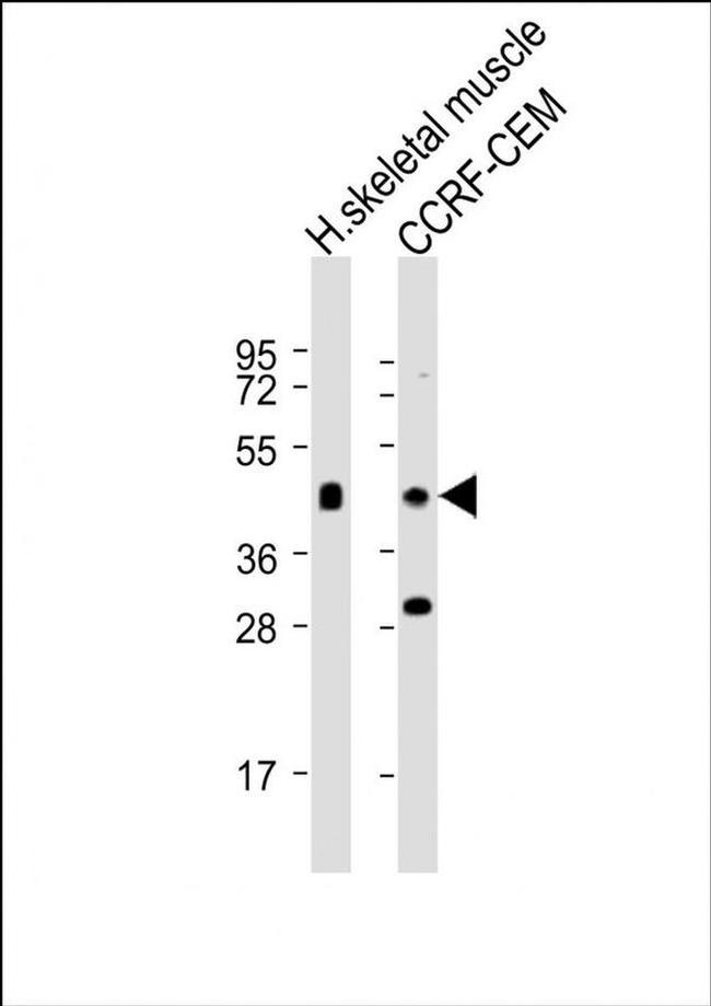 SLC16A10 Antibody in Western Blot (WB)
