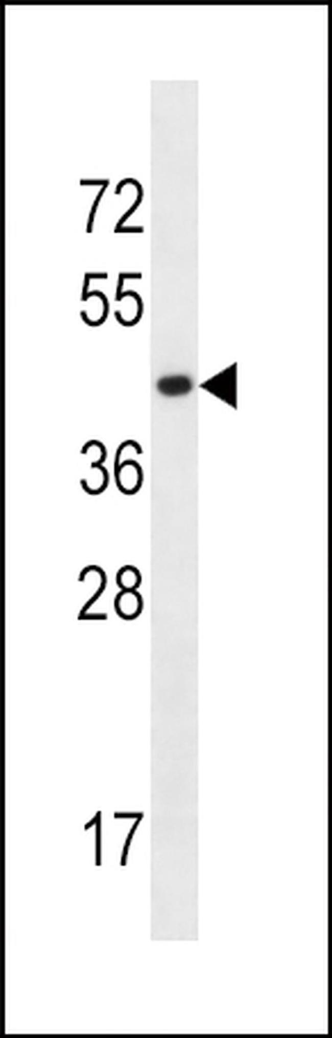 SLC16A10 Antibody in Western Blot (WB)
