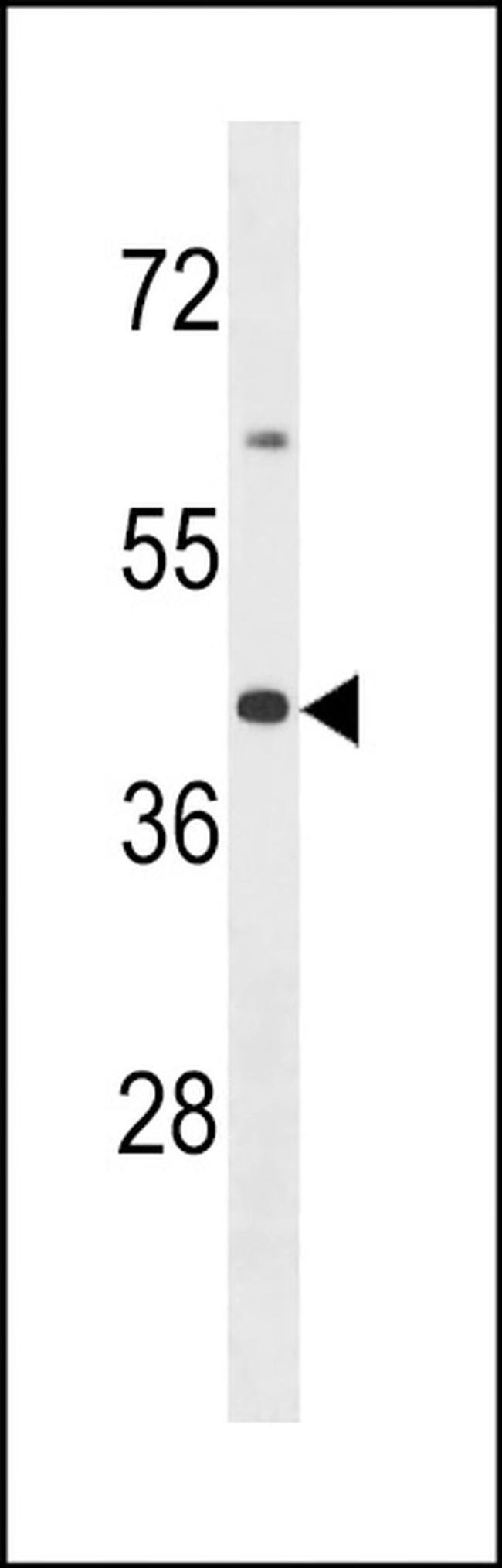 OR2B6 Antibody in Western Blot (WB)