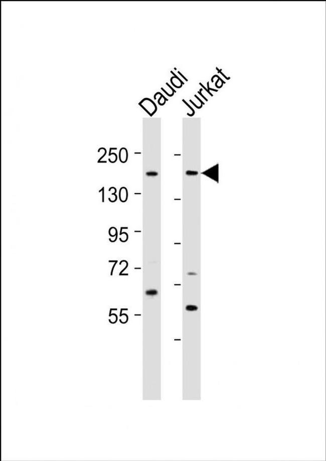 BZRAP1 Antibody in Western Blot (WB)