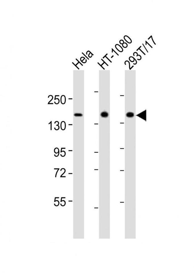 RAPGEF2 Antibody in Western Blot (WB)