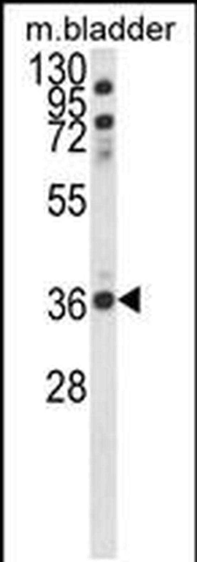 CCDC3 Antibody in Western Blot (WB)