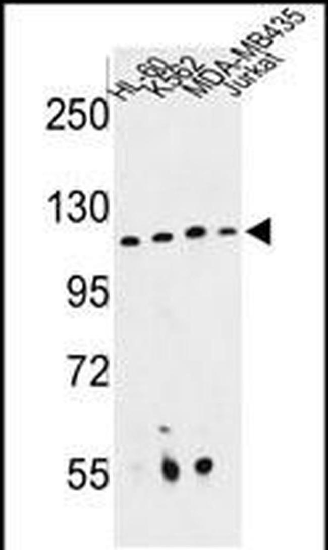 RPGRIP1 Antibody in Western Blot (WB)