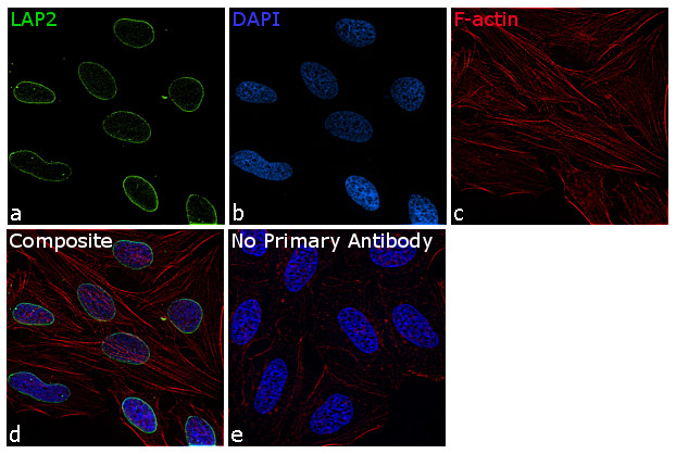 LAP2 Antibody in Immunocytochemistry (ICC/IF)