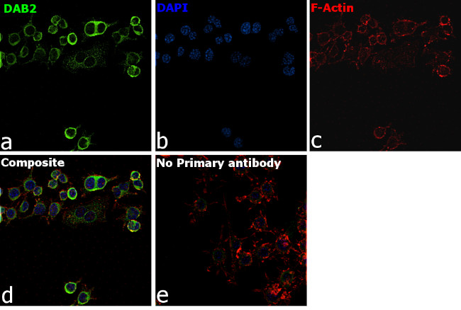 DAB2 Antibody in Immunocytochemistry (ICC/IF)