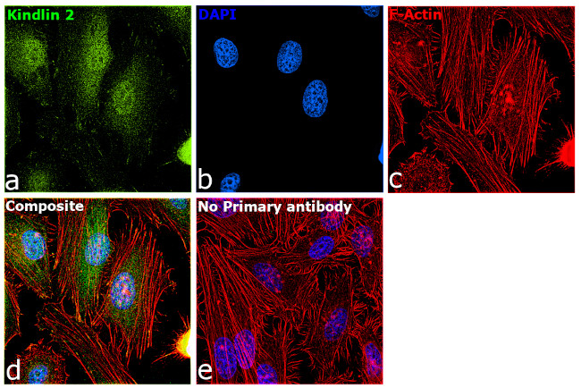 Kindlin 2 Antibody in Immunocytochemistry (ICC/IF)