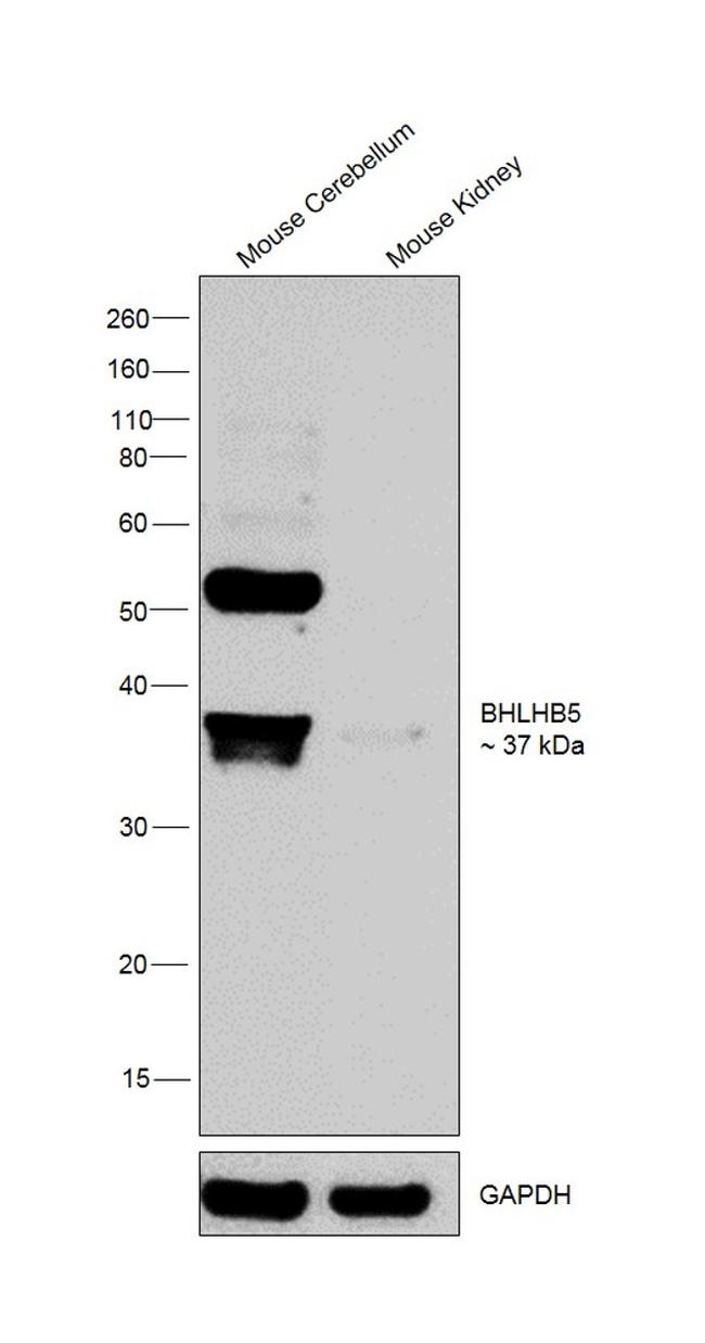 BHLHB5 Antibody in Western Blot (WB)