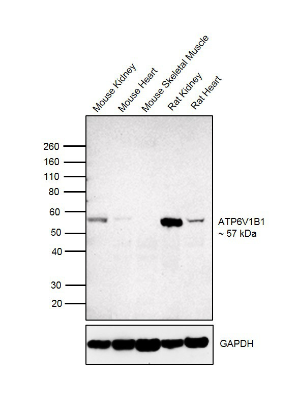 ATP6V1B1 Antibody