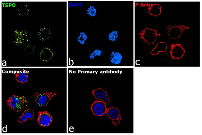 TSPO Antibody in Immunocytochemistry (ICC/IF)