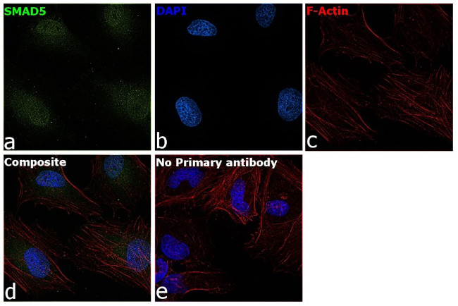 SMAD5 Antibody in Immunocytochemistry (ICC/IF)