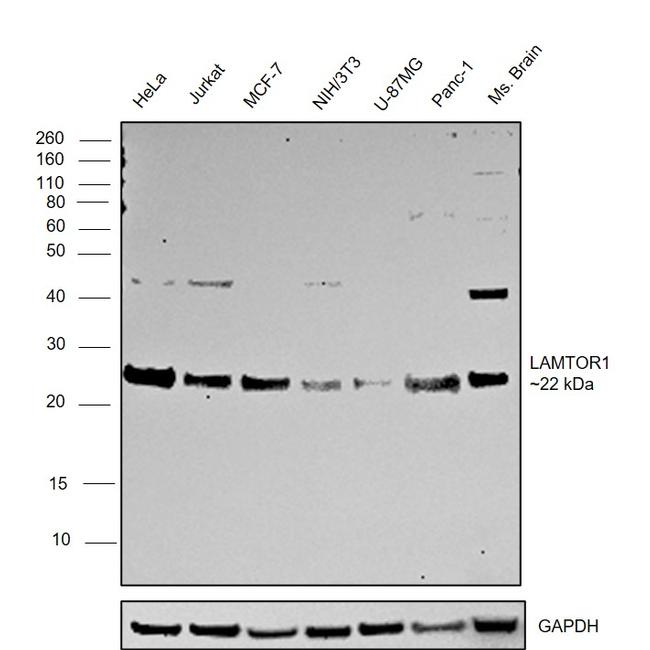 LAMTOR1 Antibody in Western Blot (WB)