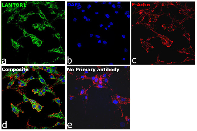 LAMTOR1 Antibody in Immunocytochemistry (ICC/IF)