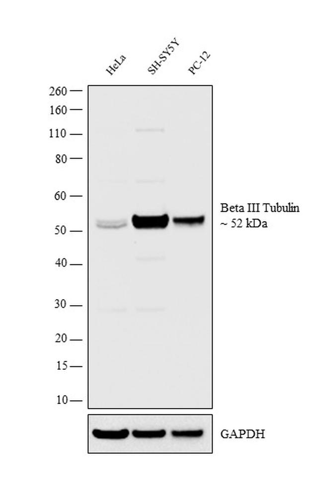 Beta III Tubulin Antibody in Western Blot (WB)
