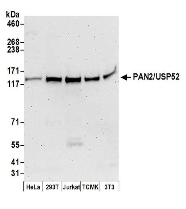 PAN2/USP52 Antibody in Western Blot (WB)