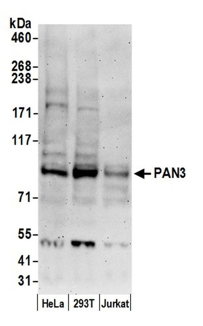 PAN3 Antibody in Western Blot (WB)