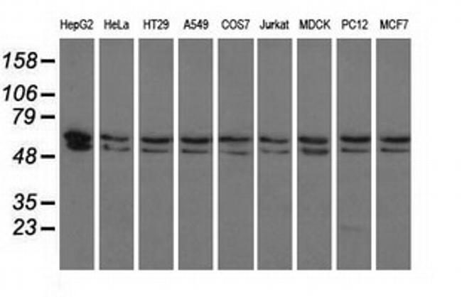PANK2 Antibody in Western Blot (WB)