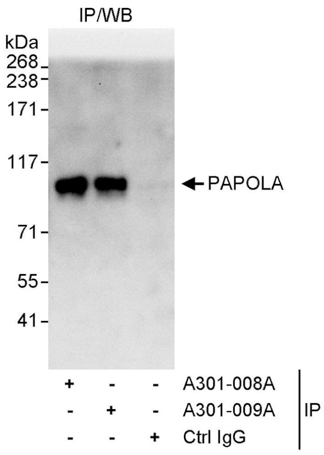 PAPOLA Antibody in Immunoprecipitation (IP)