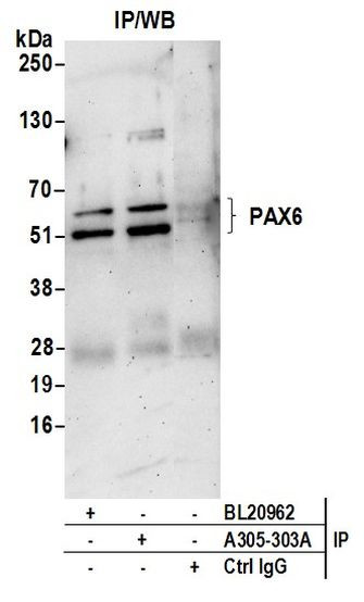 PAX6/AN Antibody in Immunoprecipitation (IP)