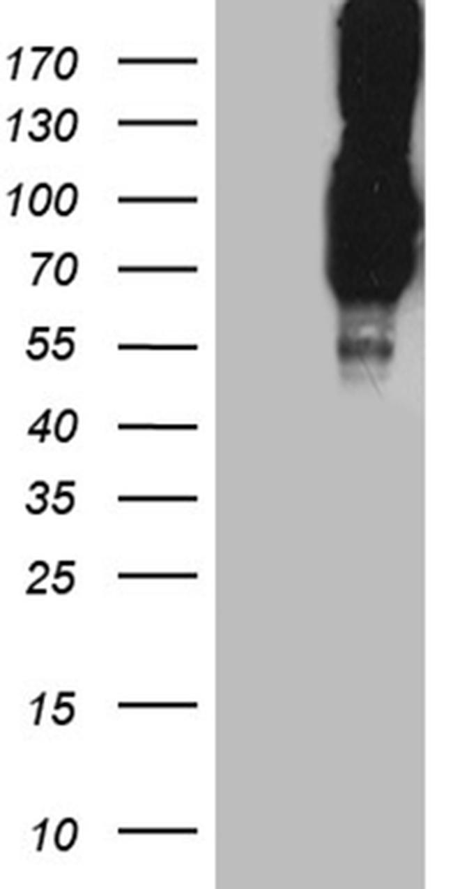PCSK9 Antibody in Western Blot (WB)