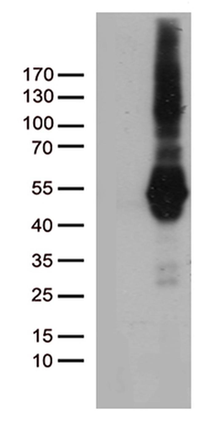 PDCD2L Antibody in Western Blot (WB)