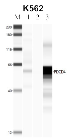 PDCD4 Antibody in Immunoprecipitation (IP)