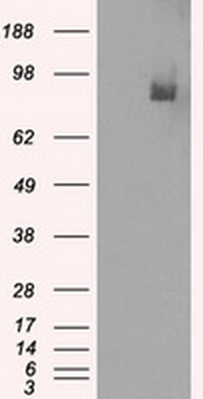 PDE10A Antibody in Western Blot (WB)