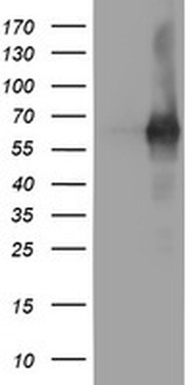 PDE1B Antibody in Western Blot (WB)