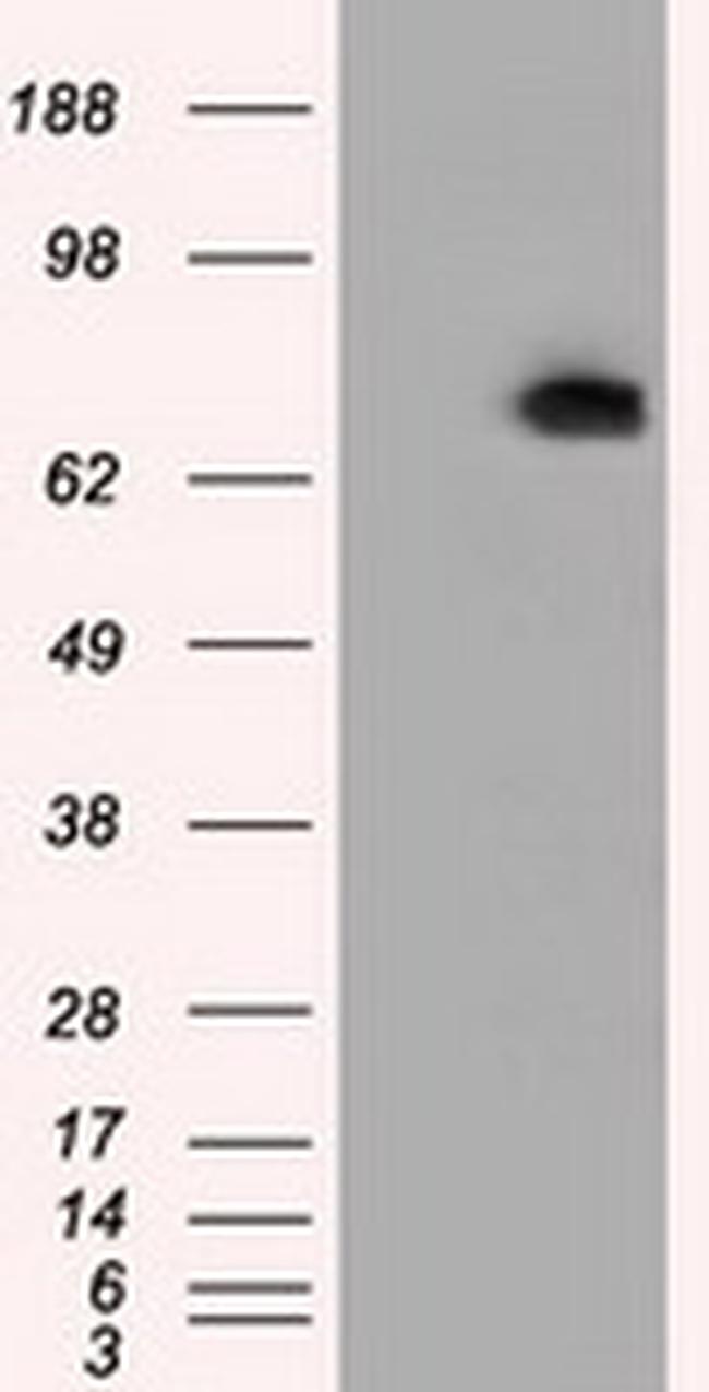 PDE4A Antibody in Western Blot (WB)