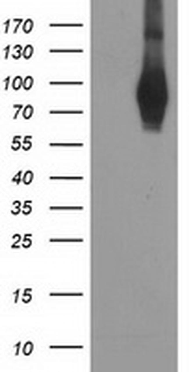 PDE4B Antibody in Western Blot (WB)