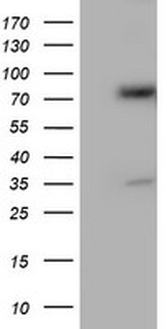 PDIA4 Antibody in Western Blot (WB)