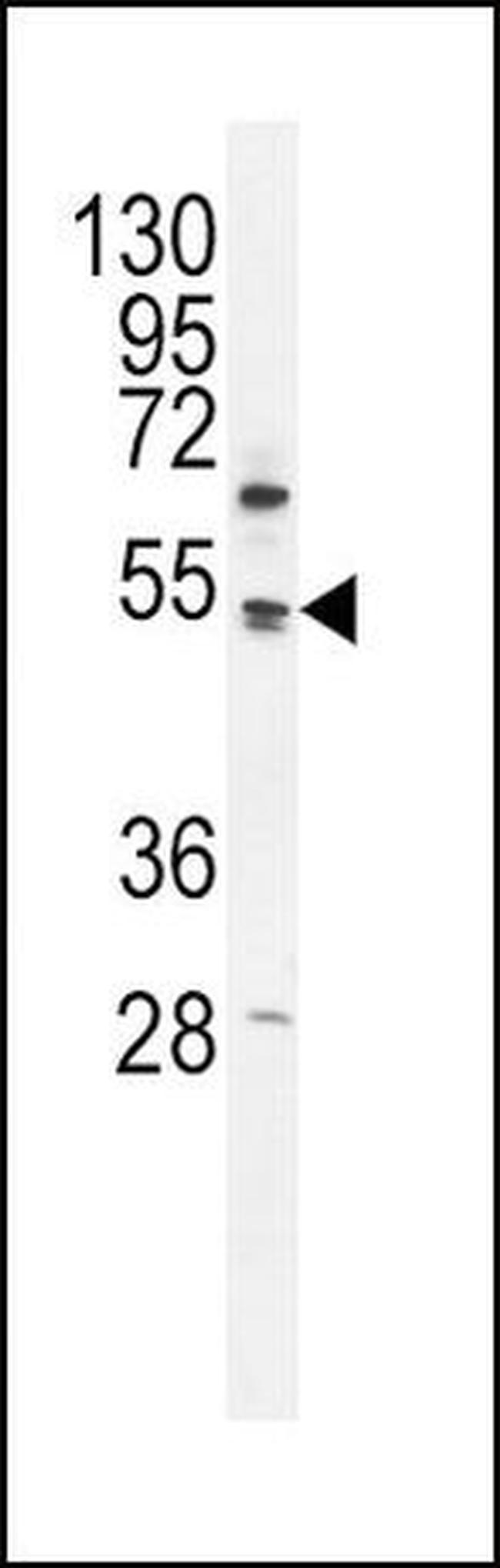 PDK4 Antibody in Western Blot (WB)