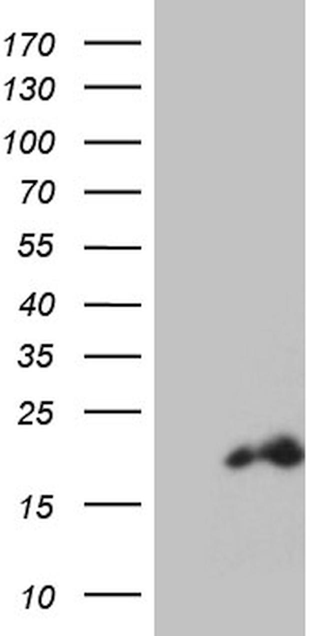 PDRG1 Antibody in Western Blot (WB)