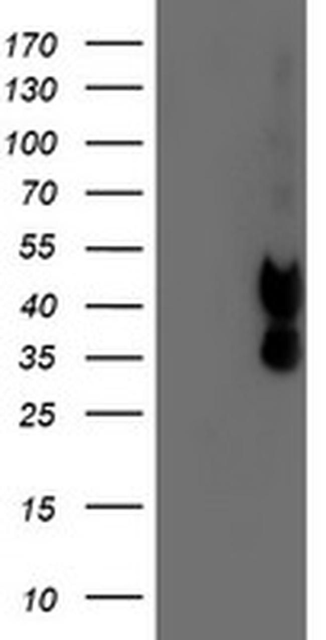 PDSS2 Antibody in Western Blot (WB)