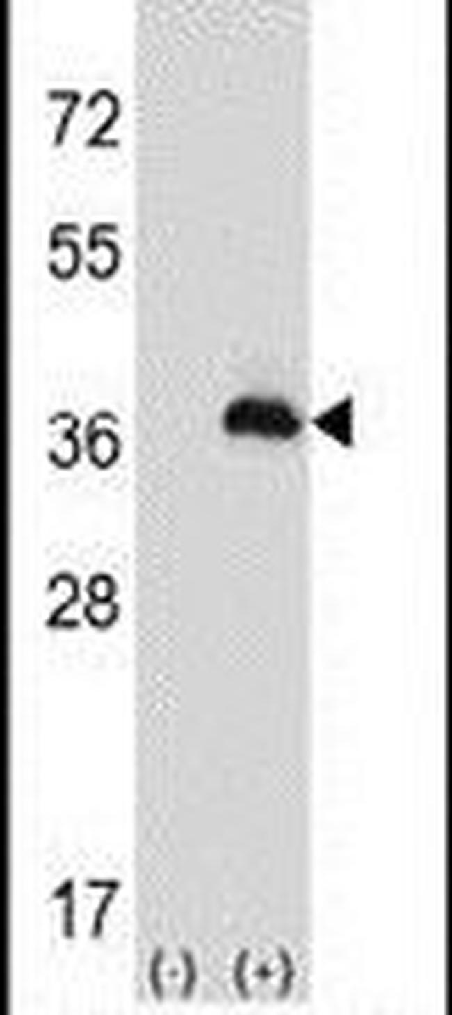 PEX16 Antibody in Western Blot (WB)