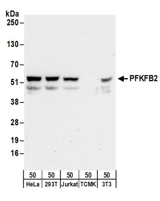 PFKFB2 Antibody in Western Blot (WB)
