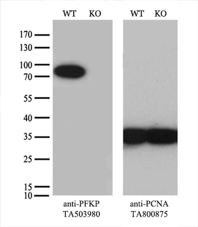 PFKP Antibody in Western Blot (WB)