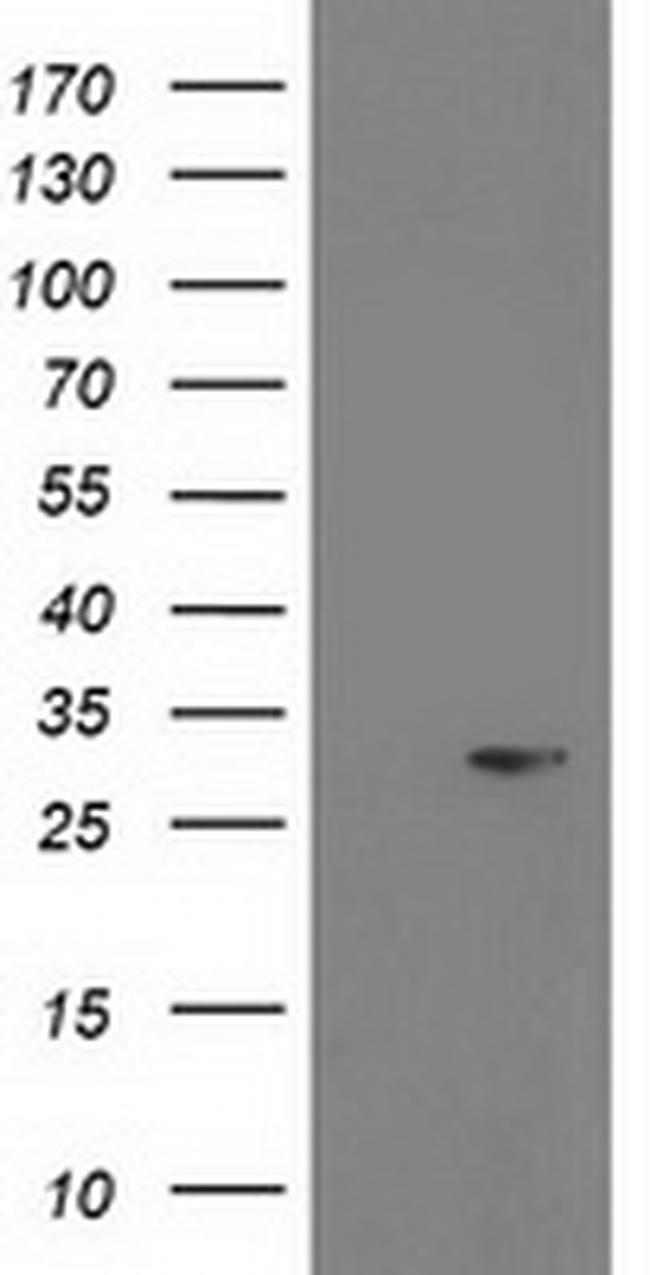 PGAM2 Antibody in Western Blot (WB)