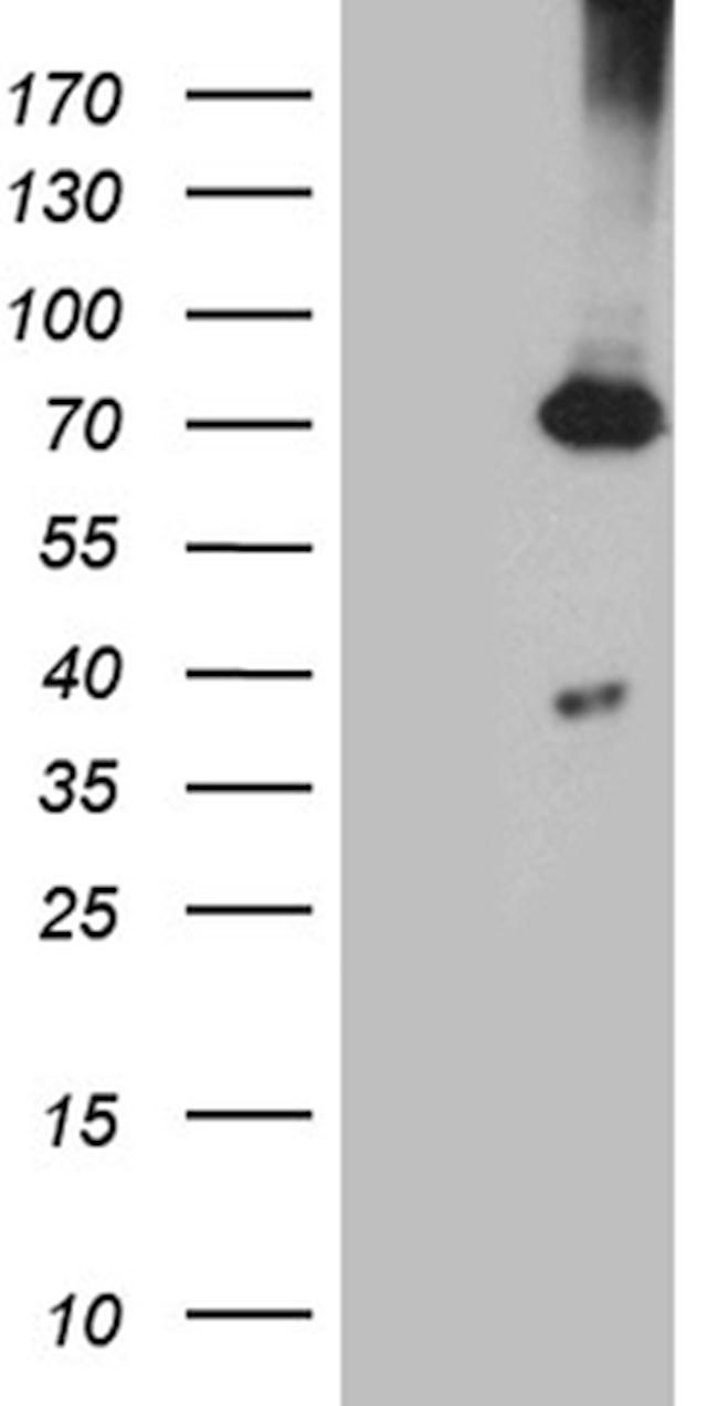 PGM2L1 Antibody in Western Blot (WB)