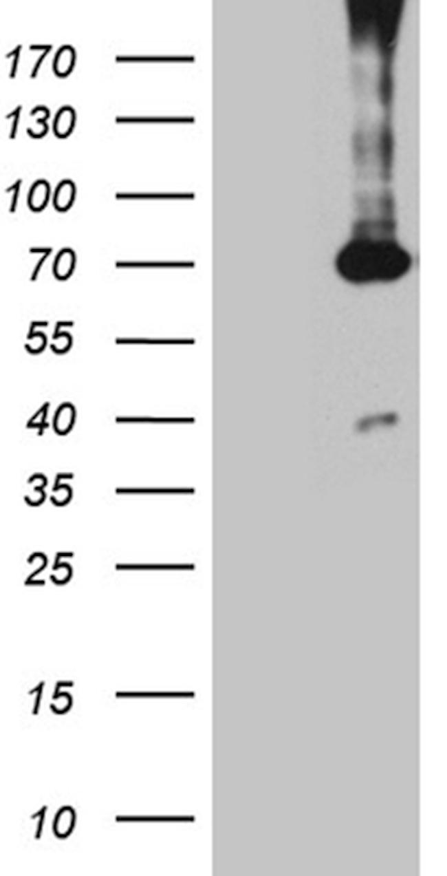 PGM2L1 Antibody in Western Blot (WB)