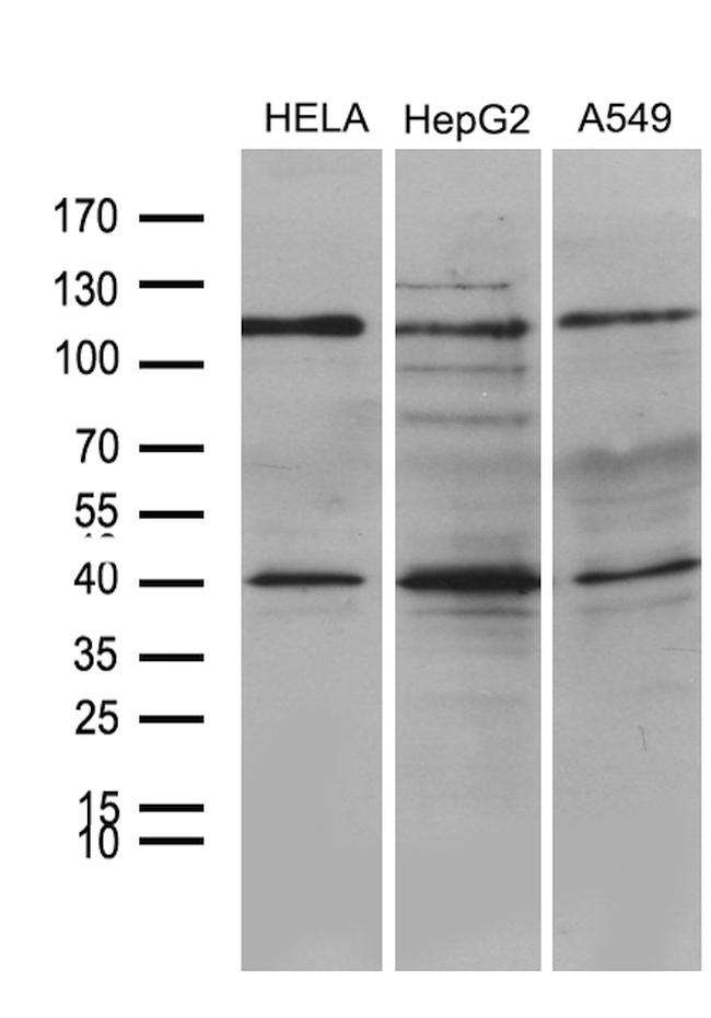 PHF20L1 Antibody in Western Blot (WB)