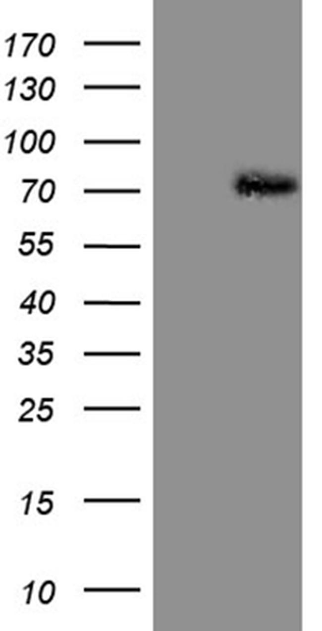 PIAS2 Antibody in Western Blot (WB)